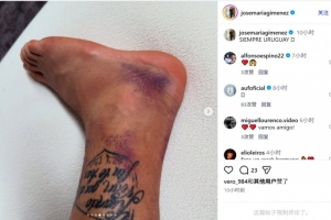 世界杯理性直播_免费高清观看_首发阵容_战术解读
